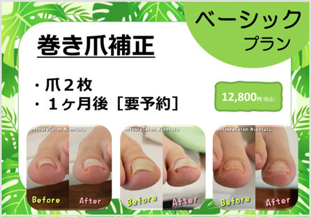 フットケアサロンニコルル