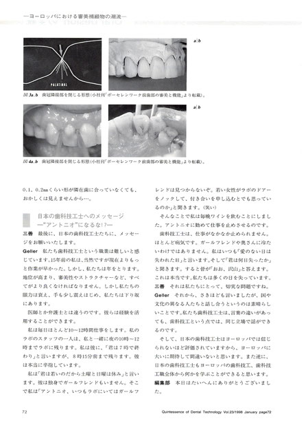 ウィリーゲラー氏の講演とテーブルクリニックビデオ　3本　ポーセレン　歯科技工 Putting the 