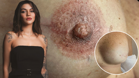 corso areola e camouflage