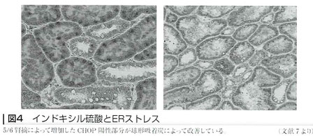 インドキシル硫酸とERストレス