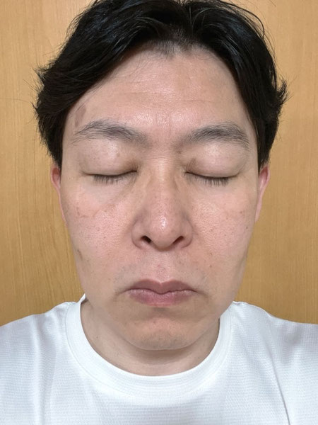 1年後（2026年6月7日撮影）