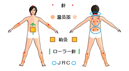 「生理痛」「更年期」