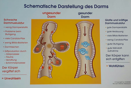 Auf dem Bild ist die schematische Darstellung des Darms zu sehen. Ein gesunder Darm, im Vergleich ein ungesunder Darm. Die Aufnahme steht symbolisch für das Gesundheitscoaching mit Svenja Lampke.