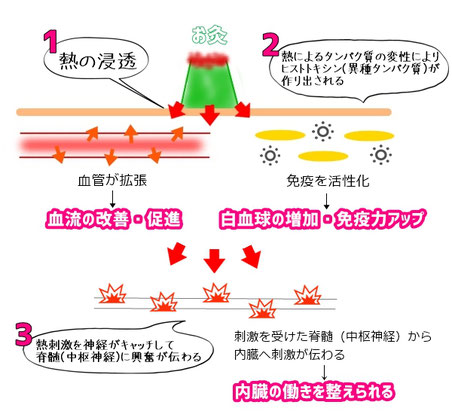 お灸の効果