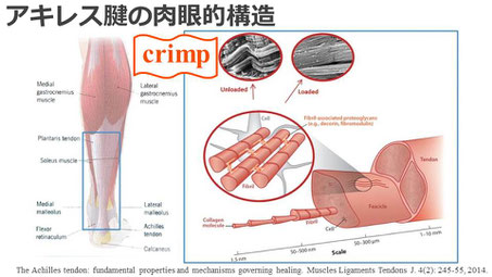  豊田市の接骨院　おおつか接骨院　アキレス腱断裂保存療法　スライド1