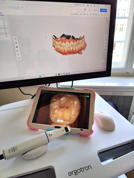 Intraoralscanner und digitales Zahnbild auf Tablet in der Zahnarztpraxis Doumit in Berlin-Friedenau – moderne Dentaltechnik für präzise Behandlungsergebnisse.
