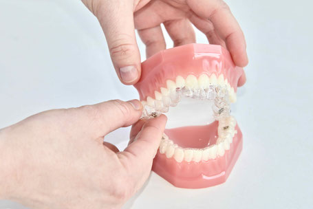 Zahnärztin für Kieferorthopädie Gröbenzell, Frau Ost, erklärt an einem Gebissmodell die Therapie mit unsichtbaren Invisalign Zahnschienen.