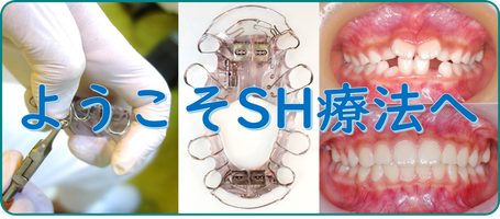 ようこそSH療法へ ／SH療法の治療の流れ ／ SH療法の症例 ／ SH療法Q＆A