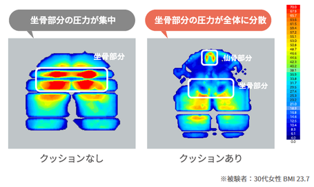 座骨に集中する圧力を分散