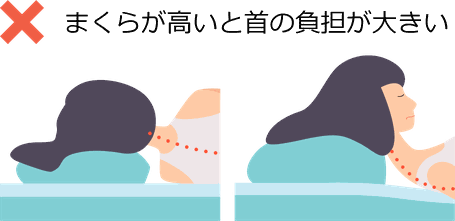 まくらが高いと首の負担が大きい