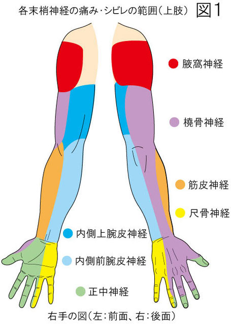 末梢神経　痛み・シビレの範囲：上肢