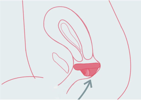 Rayne Care Menstrual Disc