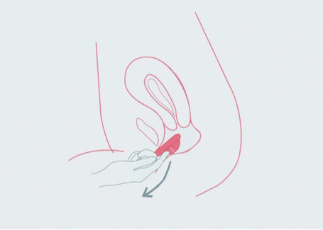 Rayne Care Menstrual Disc