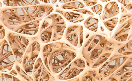 Osteoporose Medikamente, Osteoporose Behandlung