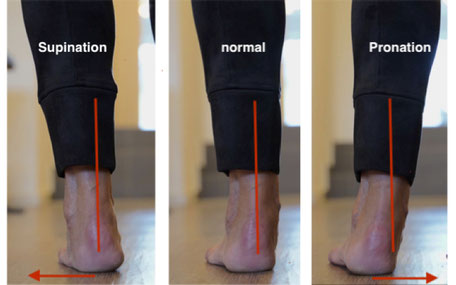 linker Fuß in Supination, normal und Pronation