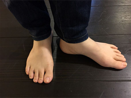 ①私の足です。つま先が四角い形をしています(スクエアトゥ)→