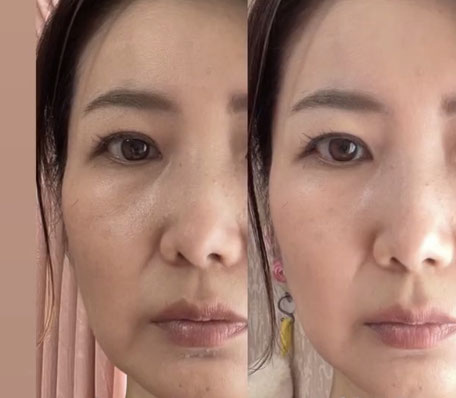 50歳、女性の症例