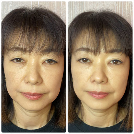 50代、女性の症例