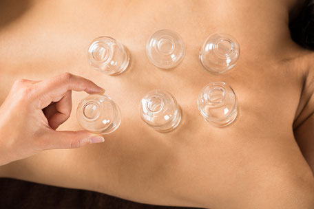 Cupping Therapy