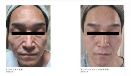 男性のスキンケアもおまかせください