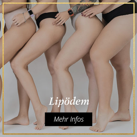 Behandlung von Lipödem bei Bargello AESTHETIK in Giessen