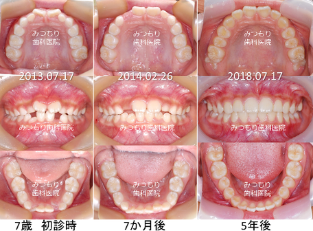 画像をクリックすると拡大します