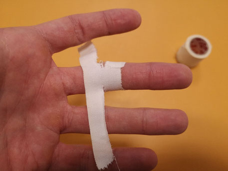 Tejping palca - fizjoterapia po zerwaniu troczka, krok 5.