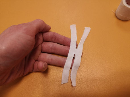 Tejping palca - fizjoterapia po zerwaniu troczka, krok 3.