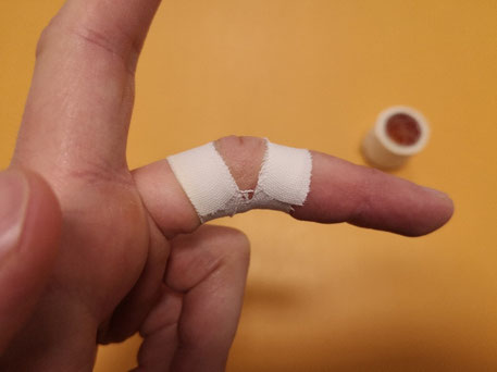 Tejping palca - fizjoterapia po zerwaniu troczka, krok 6.
