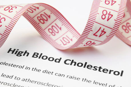 Debunking high blood cholesterol level myths