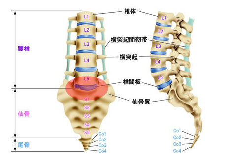 腰痛5番障害