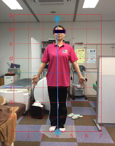骨盤の歪みがある女性