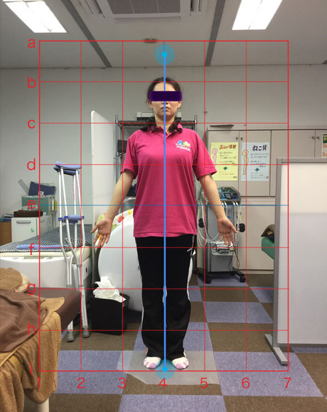 骨盤矯正をした女性