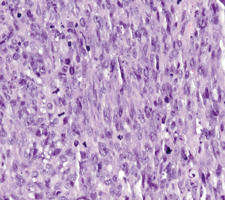 IHC staining of GIST-T1 xenograft tumor 