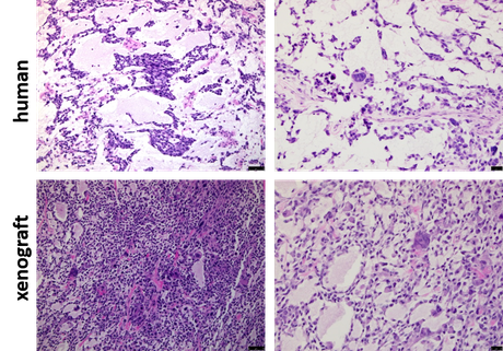 IHC staining of MFS-SN1 human tumor vs. xenograft tumor