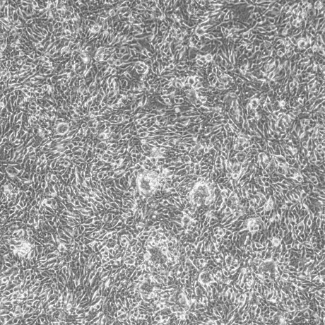 GIST882 light microscope image