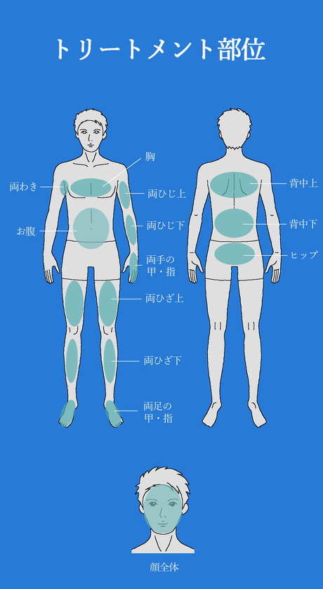 メンズサロンフジイ 脱毛 メニュー 部位画像