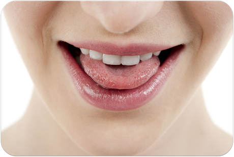 Leider oft vernachlässigt: Das Reinigen der Zunge! Welche Folgen kann das haben? (© Dan Kosmayer - Fotolia.com)