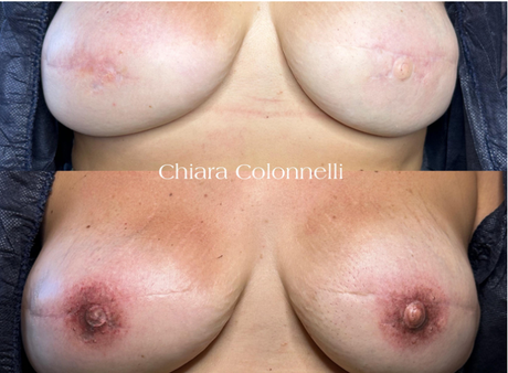 Trucco semipermanente tatuaggio eyeliner roma ricostruzione areola
