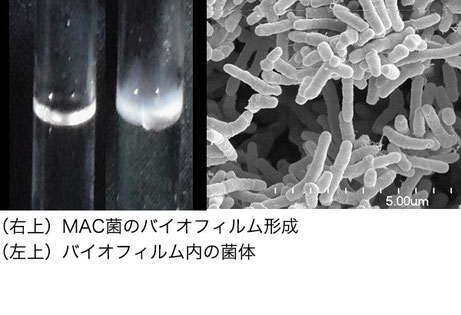 MAC菌の病原性発現機構の解明