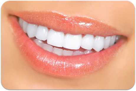 Anziehend weiße Zähne mit Bleaching (© Kurhan - Fotolia.com)