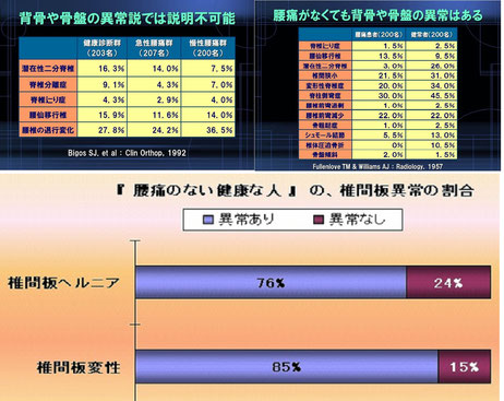 TMSジャパン資料より