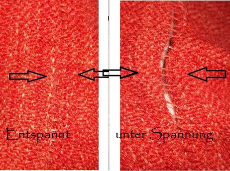 die sogenannte Thorsbergnaht, eine elastische Handnaht, die sich dehnen und wieder zusammen ziehen kann