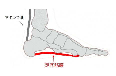 足底筋膜