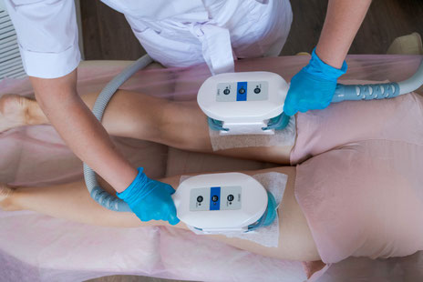 Kryolipolyse Fettreduktion Basel