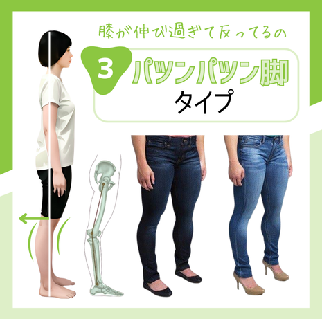パツンパツン脚解消プログラム Kyakko Bijin Co Jp ページ パツンパツン脚解消プログラム Kyakko Bijin Co Jp ページ