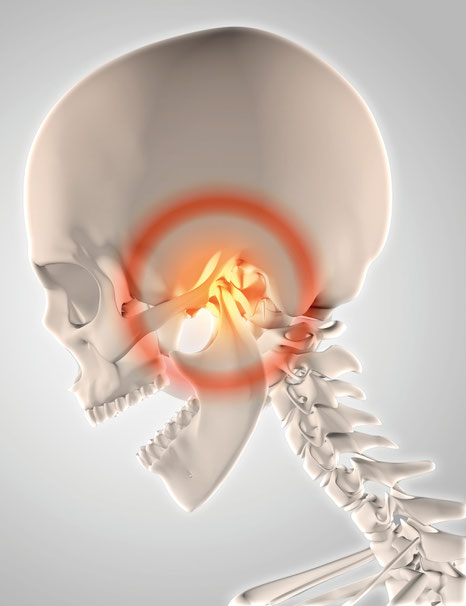 Craniomandibuläre Dysfunktion – Funktionsstörung zwischen Kiefergelenken, Kaumuskulatur und Zähnen
