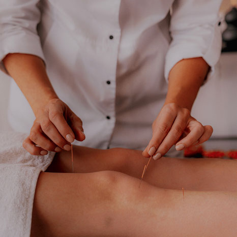 Akupunktur, Nadel therapie Basel, Dry Needle Therapie