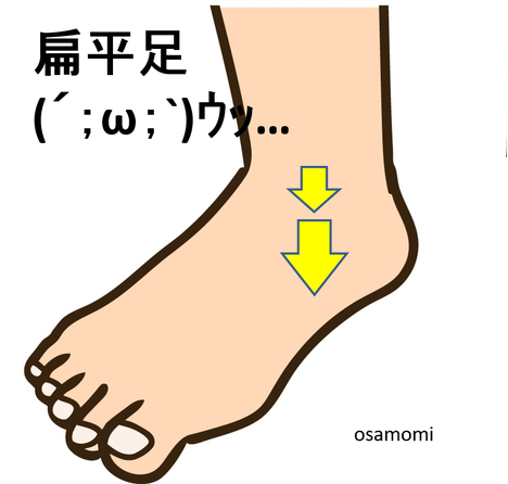 オサモミ整体院 扁平足の原因 後脛骨筋腱