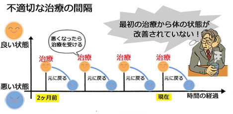 施術の間隔イラスト